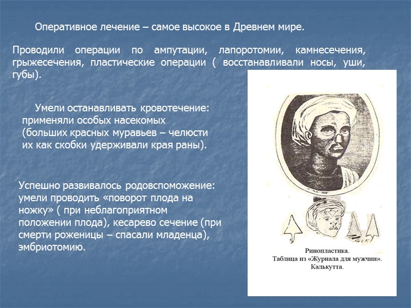 Оперативное лечение – самое высокое в Древнем мире.  Проводили операции по ампутации, лапоротомии,